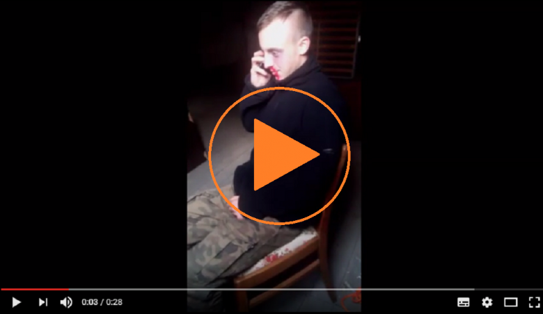 Zdjęcie ze znakiem play: pobity chłopak (charakteryzacja!) w ciemnym pomieszczeniu